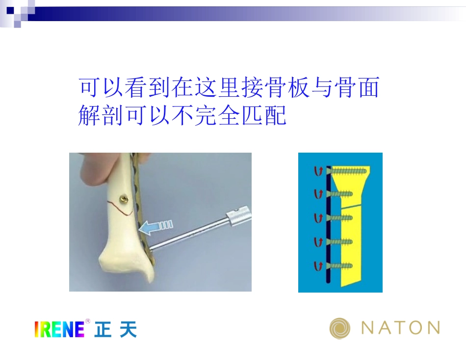 LCP操作指南中和和桥接原则的使用_第3页