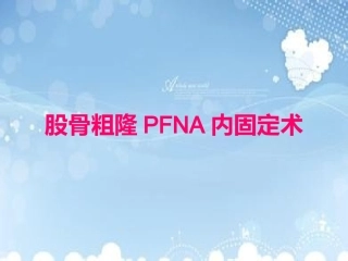 PFNA内固定术