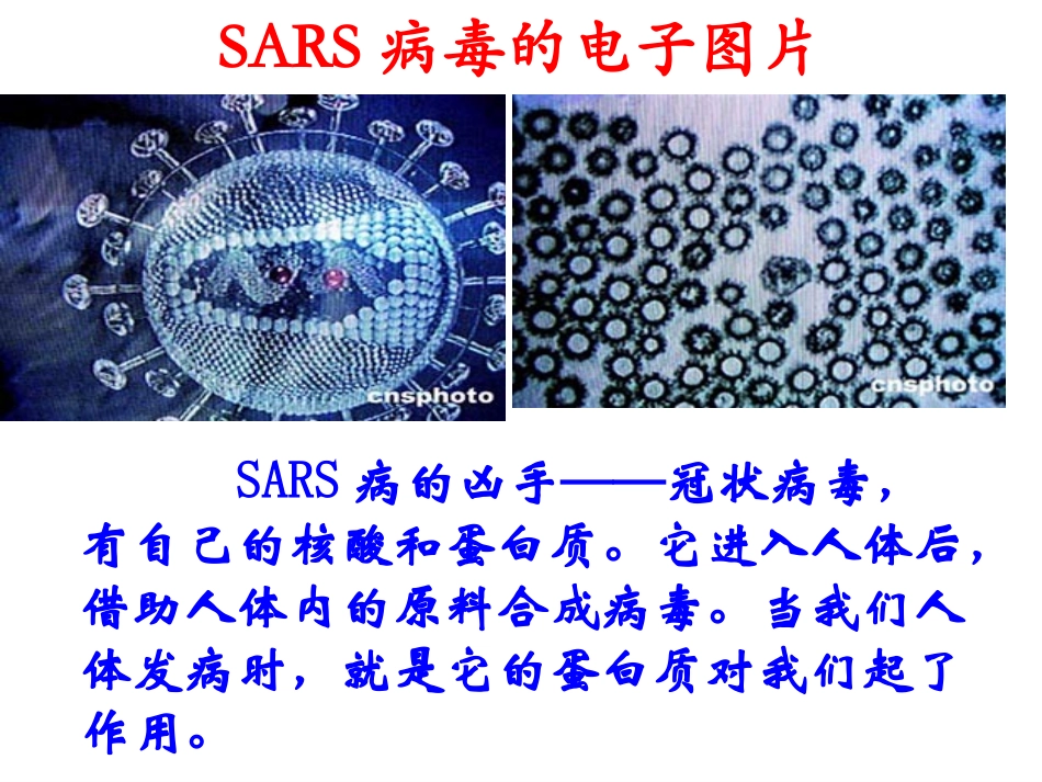 SARS病毒的电子图片_第3页