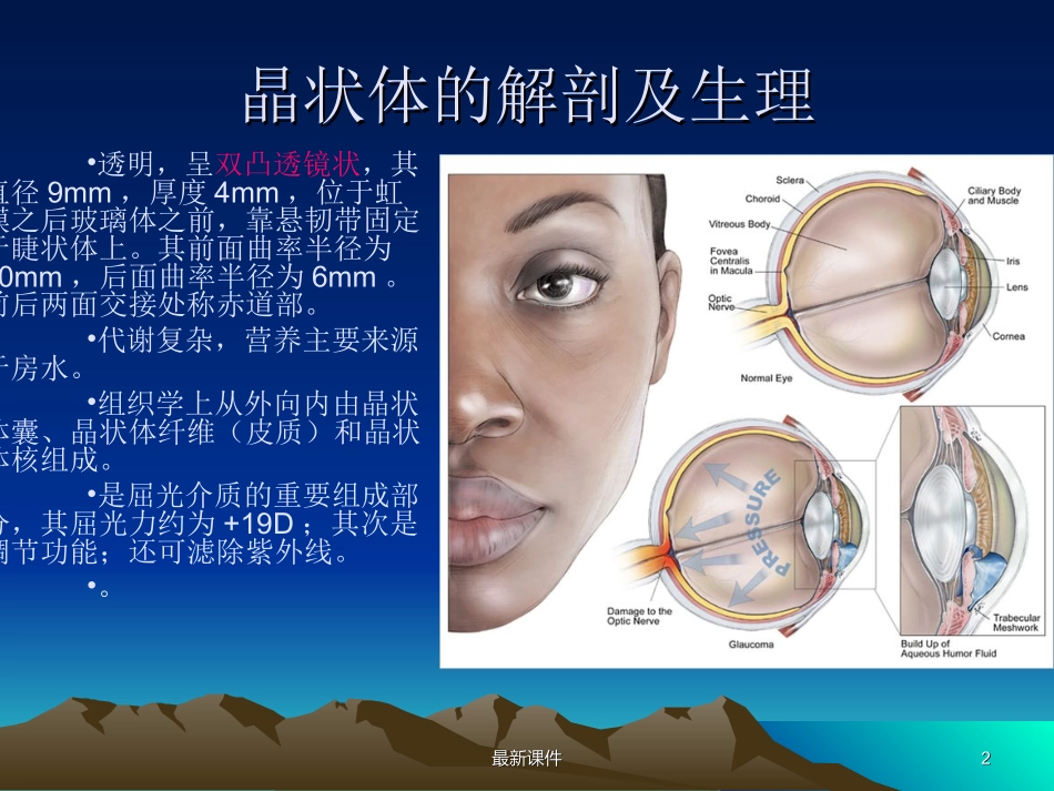 白内障课件课件_第2页