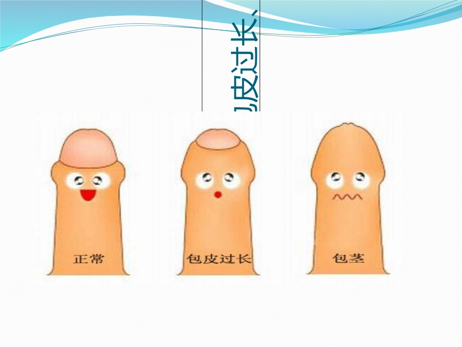 包茎包皮过长_第2页