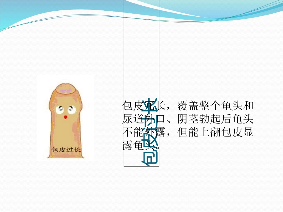 包茎包皮过长_第3页