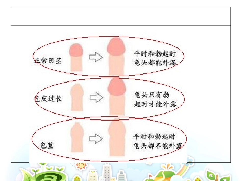 包茎包皮过长的护理_第3页