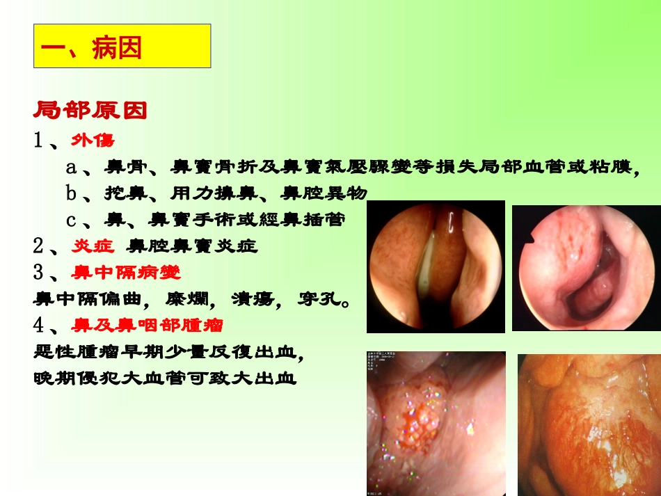 鼻出血病人的护理_第3页