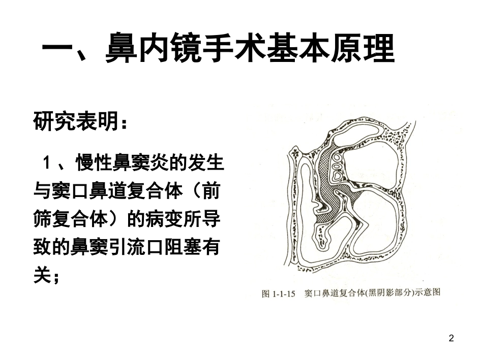 鼻内窥镜手术_第2页