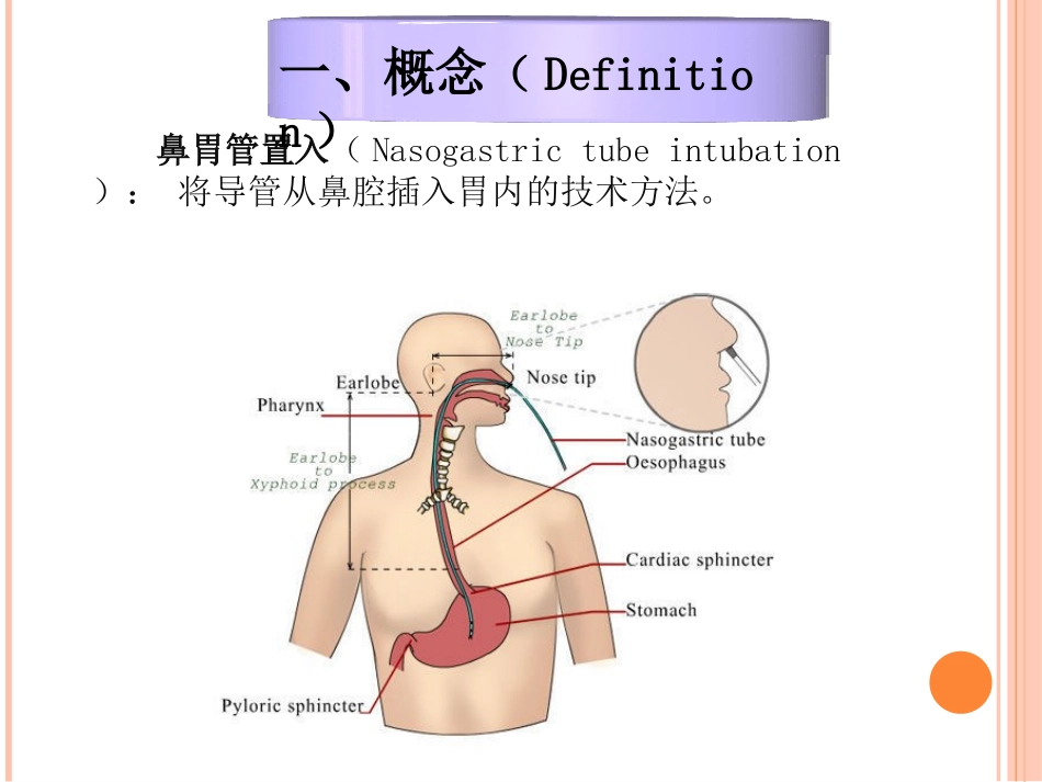 鼻胃管置入操作流程_第3页