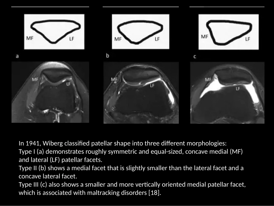 髌骨病变的影像学表现_第3页