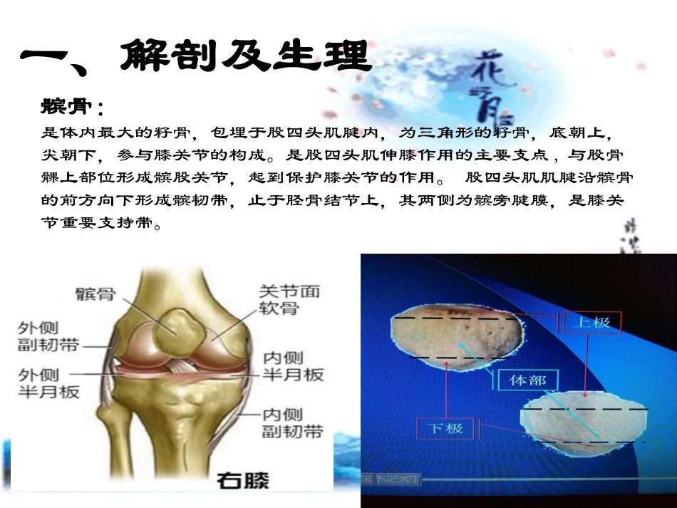 髌骨骨折课件_第3页