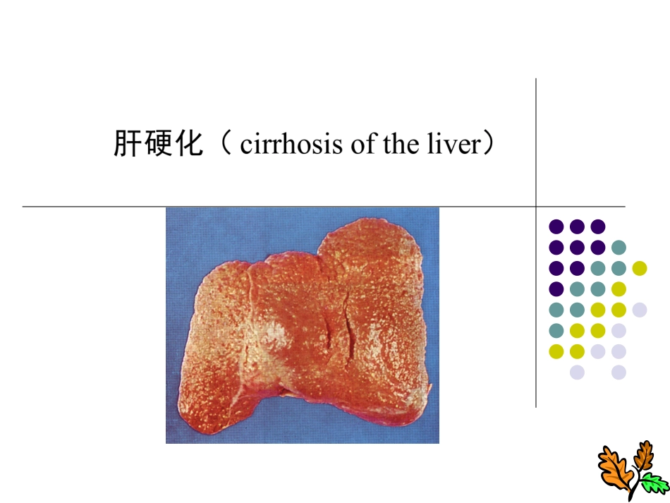 病理学肝硬化_第1页