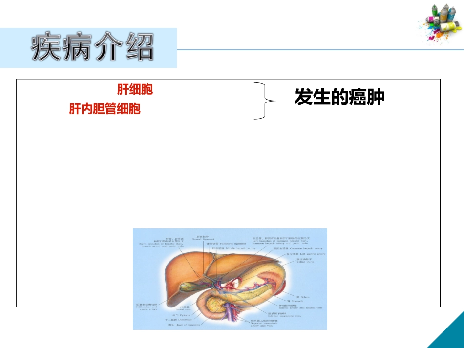 病例分析原发性肝癌患者的病例分析_第2页