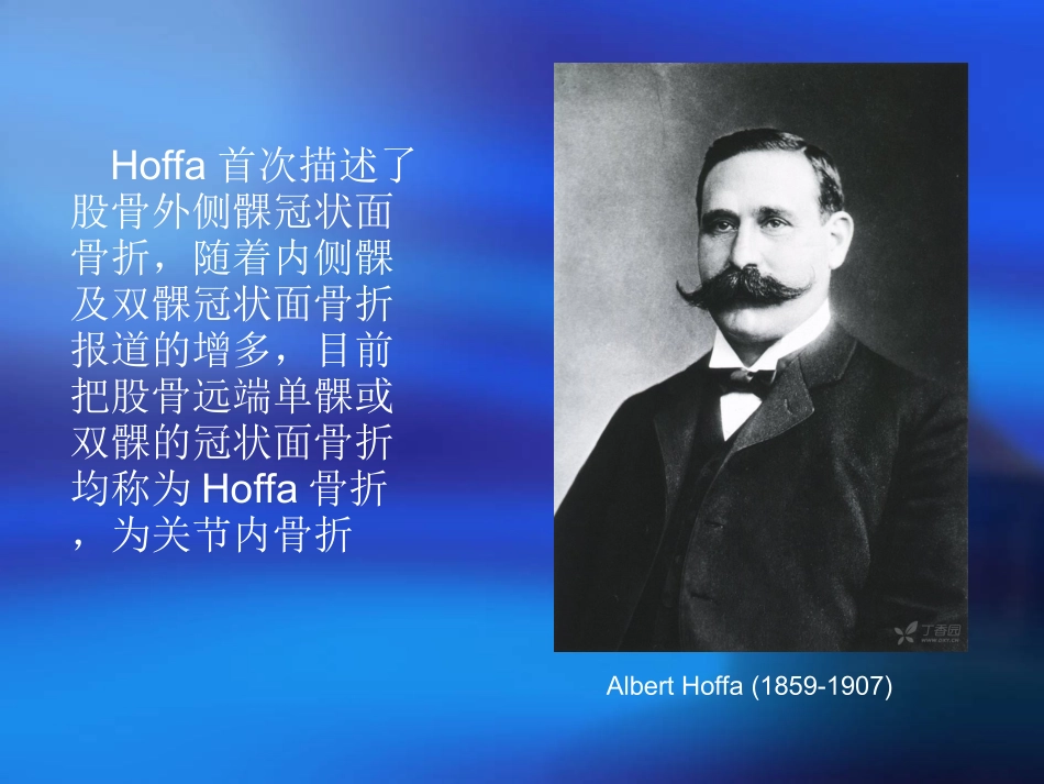 Hoffa骨折的诊断与治疗_第3页