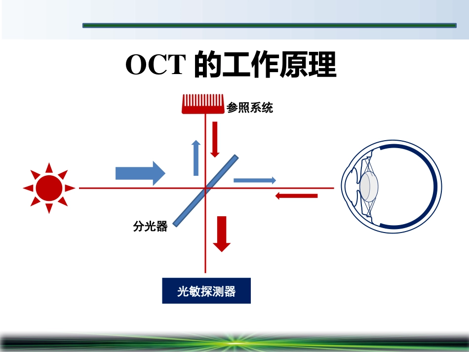 OCT在青光眼诊断中的应用_第3页