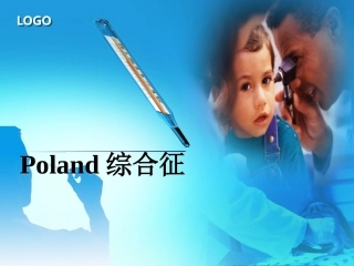 Poland综合征