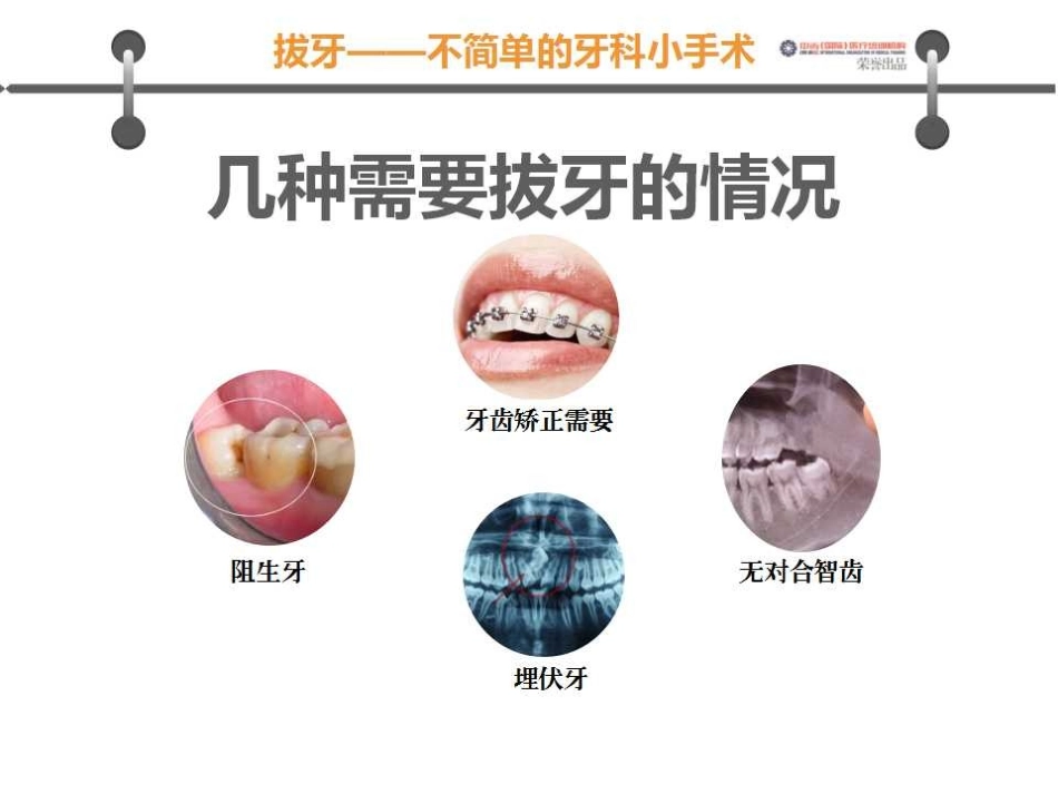 拔牙沟通图谱版_第3页