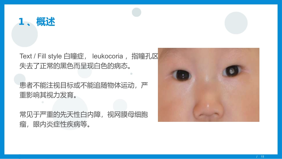 白瞳症成因及探讨_第3页