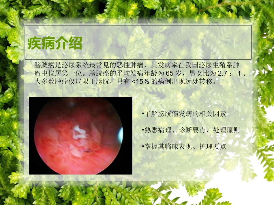 膀胱癌的护理_第2页