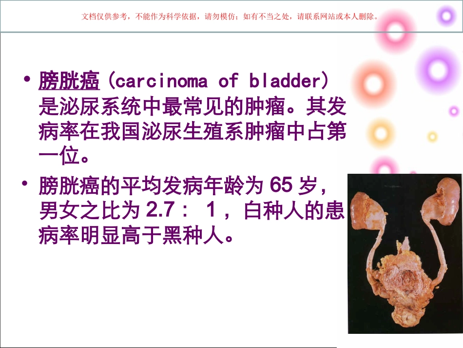膀胱肿瘤护理课件_第2页