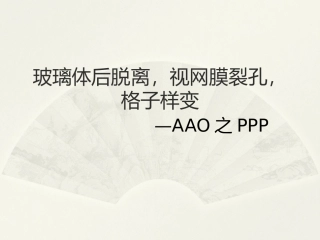 玻璃体后脱离