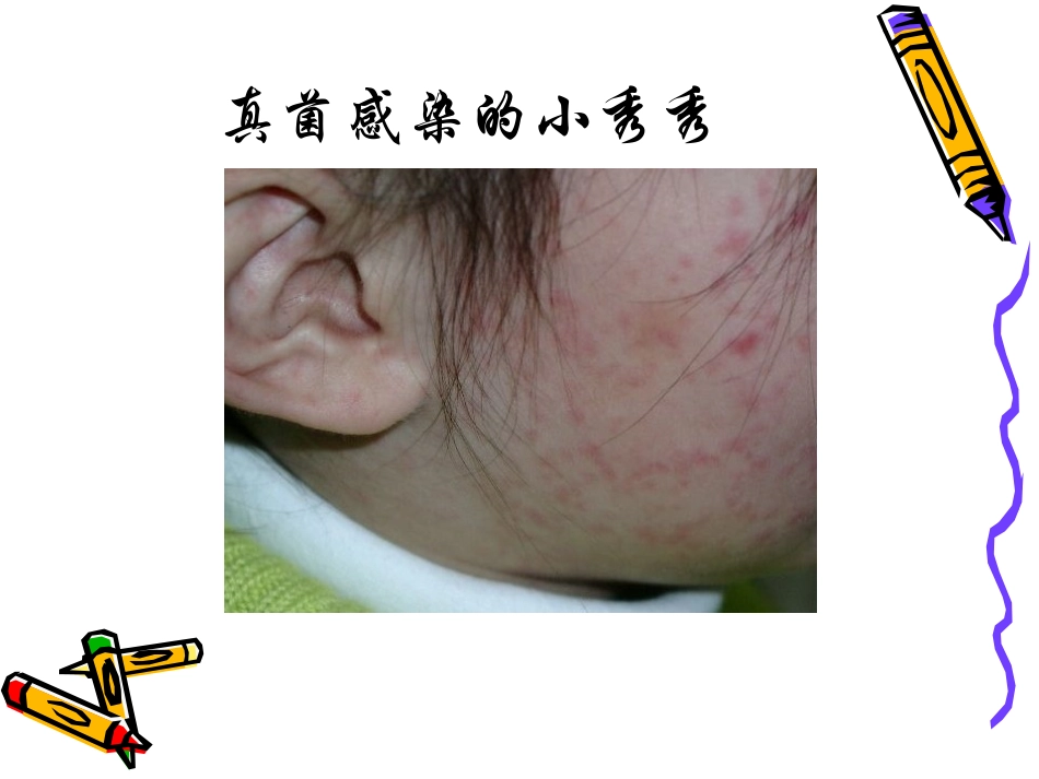 不滥用抗生素_第2页