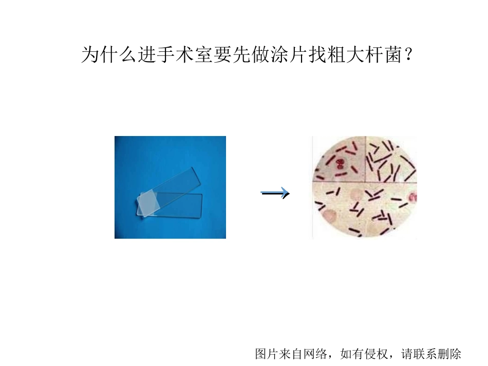 产气荚膜梭菌课件_第3页