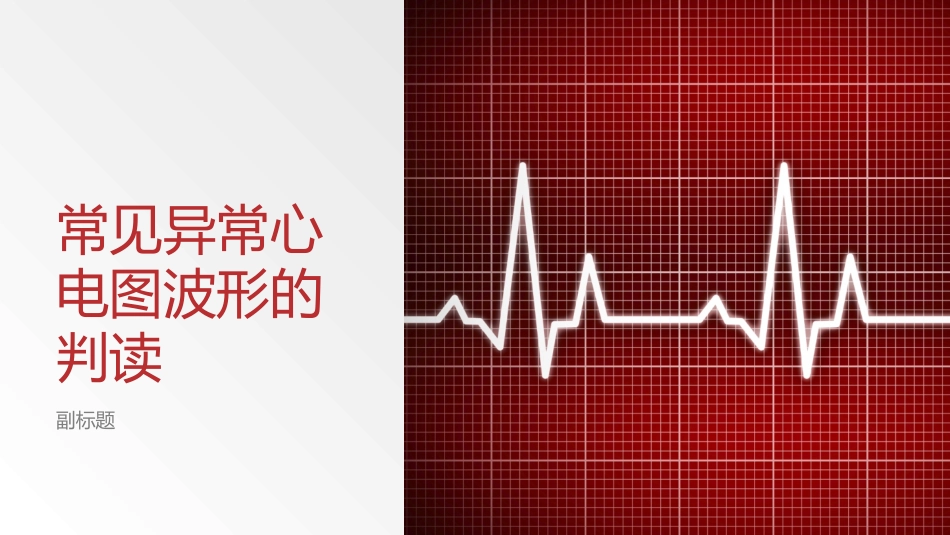 常见异常心电图波形的判读_第1页