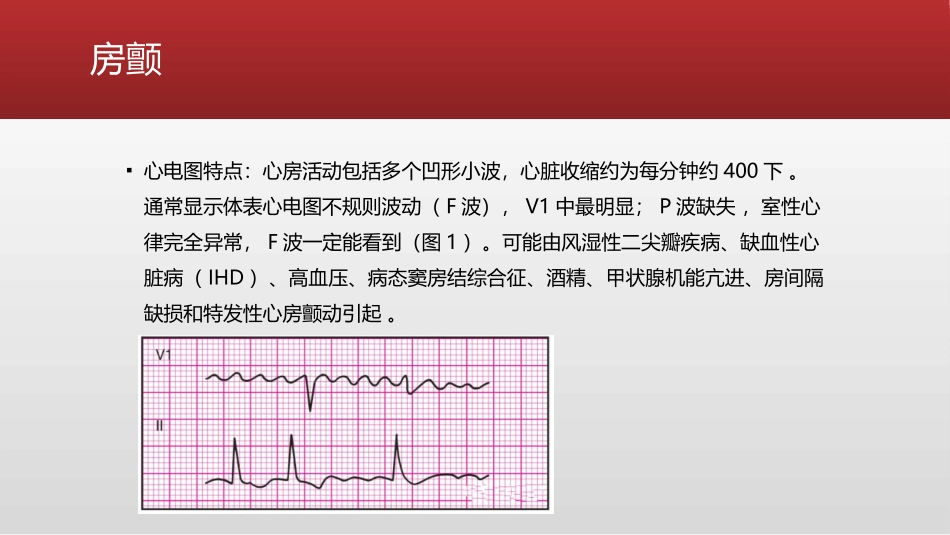 常见异常心电图波形的判读_第2页