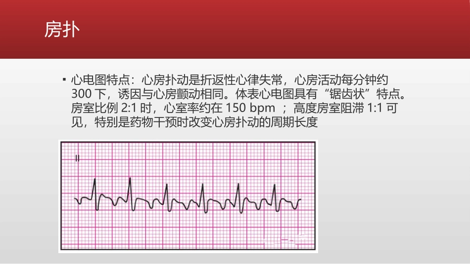 常见异常心电图波形的判读_第3页