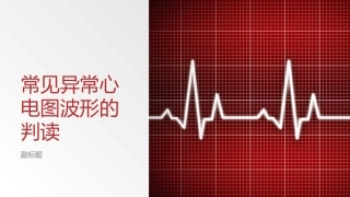 常见异常心电图波形的判读