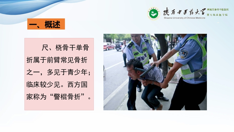 尺桡骨干单骨折_第3页