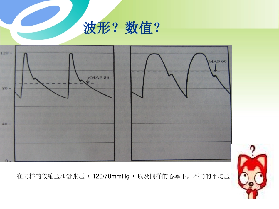从动脉波形所读到的_第3页