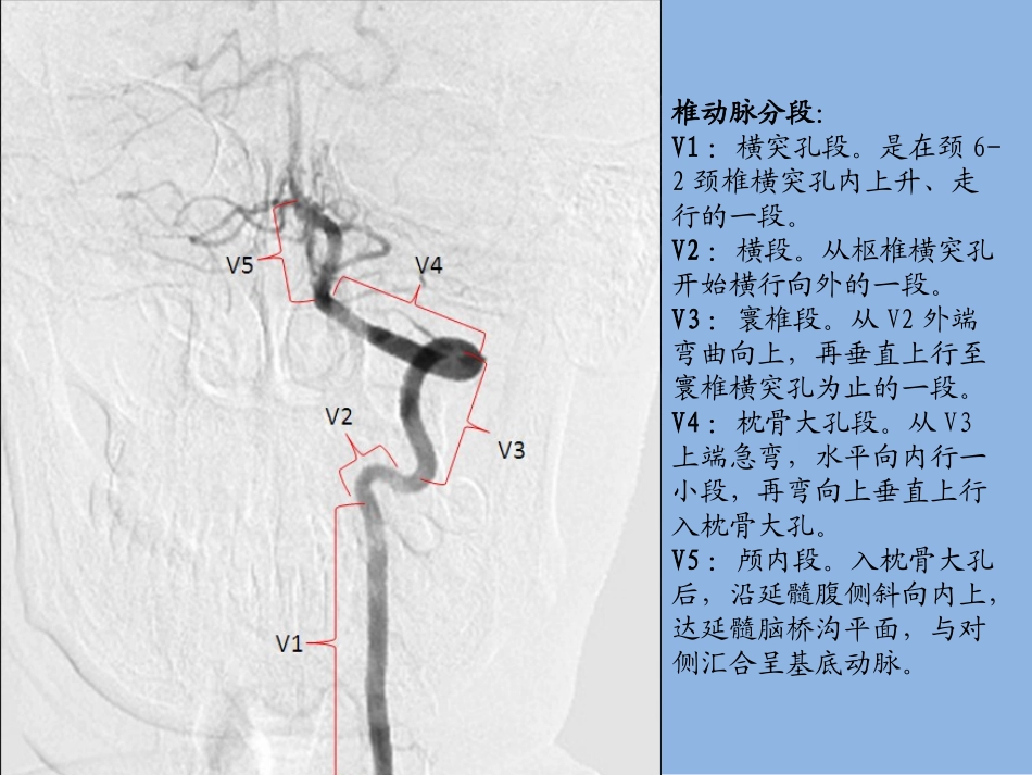 大脑动脉分段解剖图文_第3页