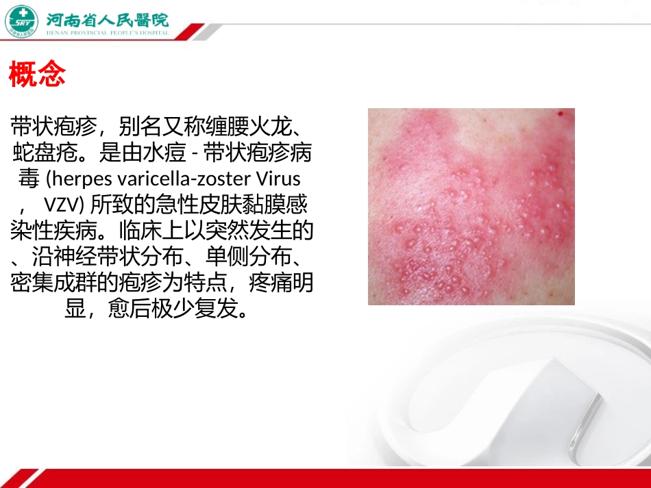 带状疱疹的护理_第2页