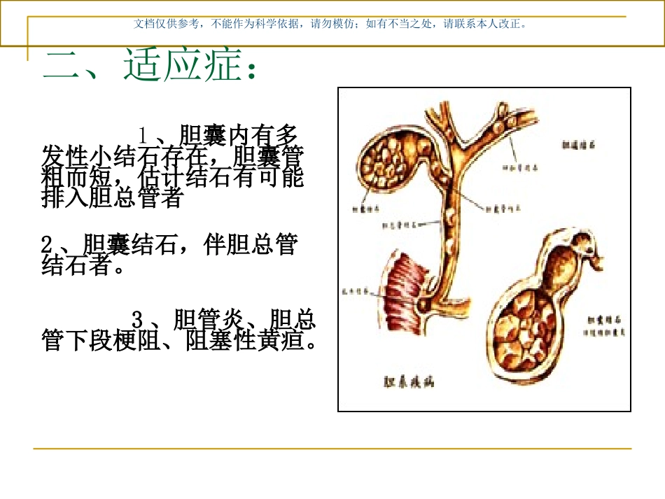 胆囊切除术胆总管切开取石术课件_第2页