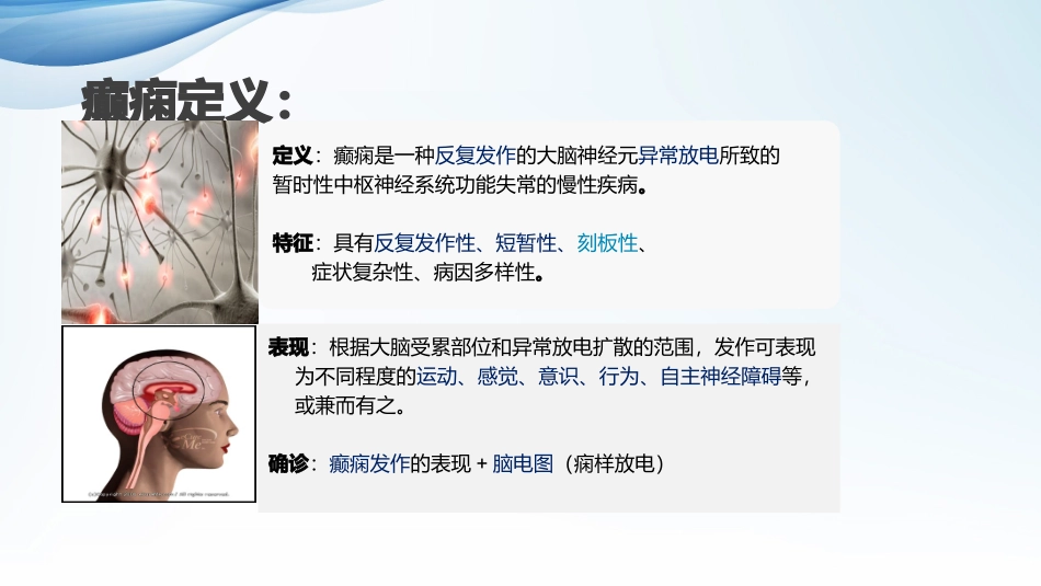 癫痫的诊断与治疗_第3页