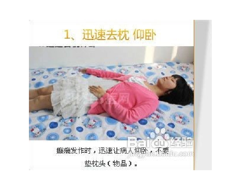 癫痫发作应急预案讲解_第3页