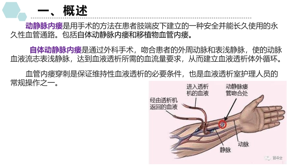 动静脉内瘘穿刺及维护_第3页