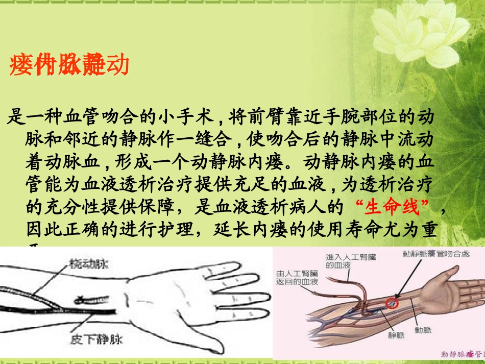 动静脉内瘘围手术期护理_第3页