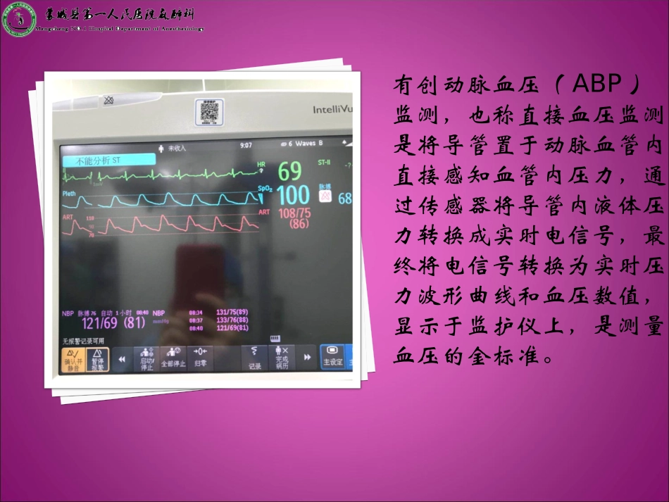 动脉穿刺置管术的操作流程_第3页