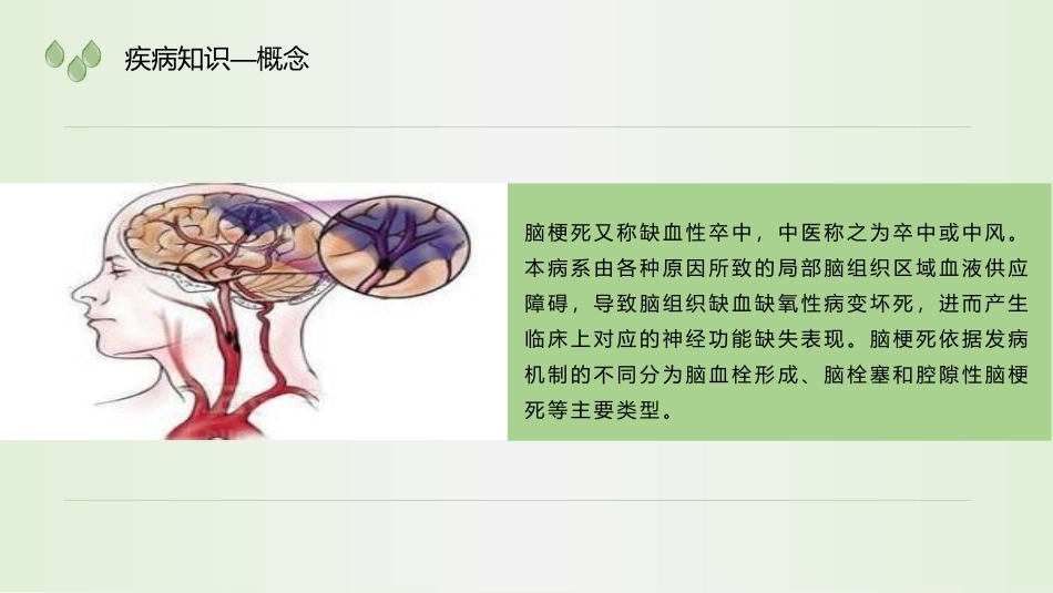 多发性脑梗死护理查房_第3页