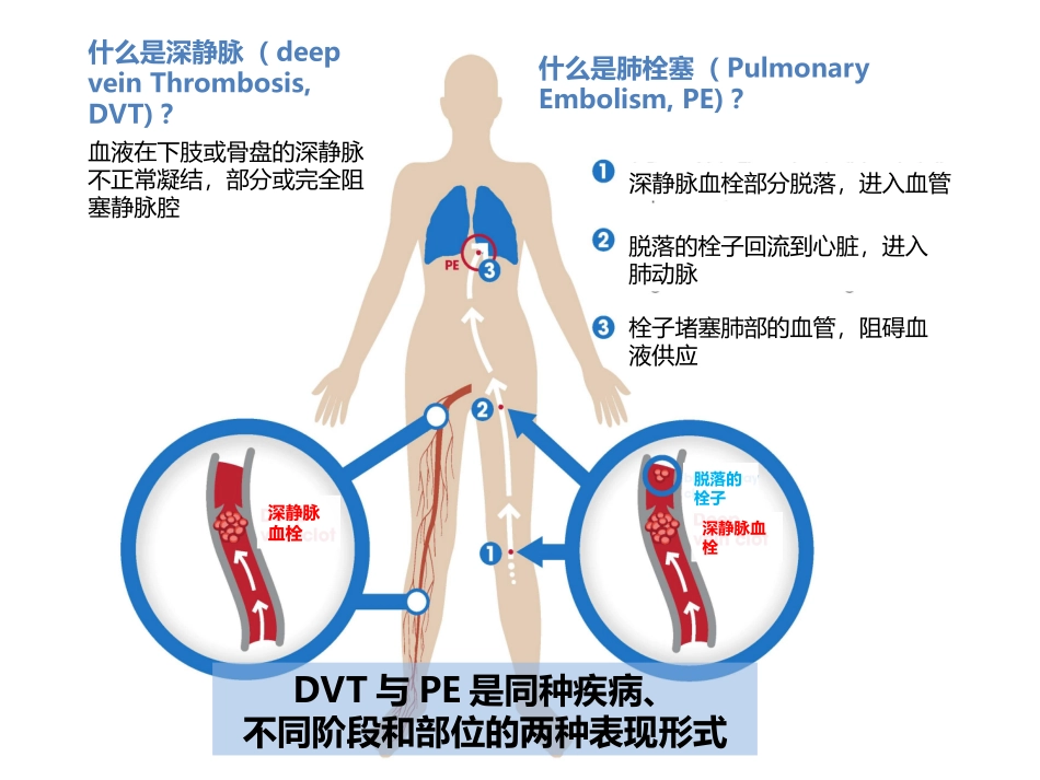 恶性肿瘤和血栓_第3页