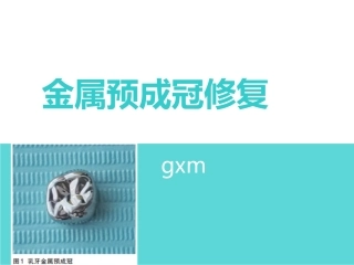 儿童金属预成冠