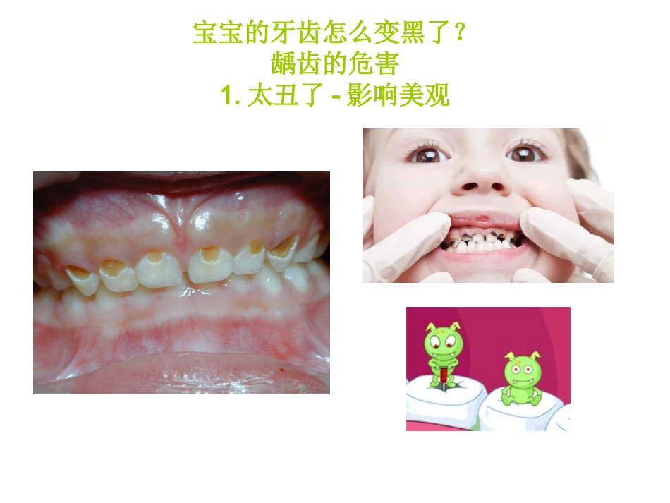 儿童口腔保健医学课件_第2页
