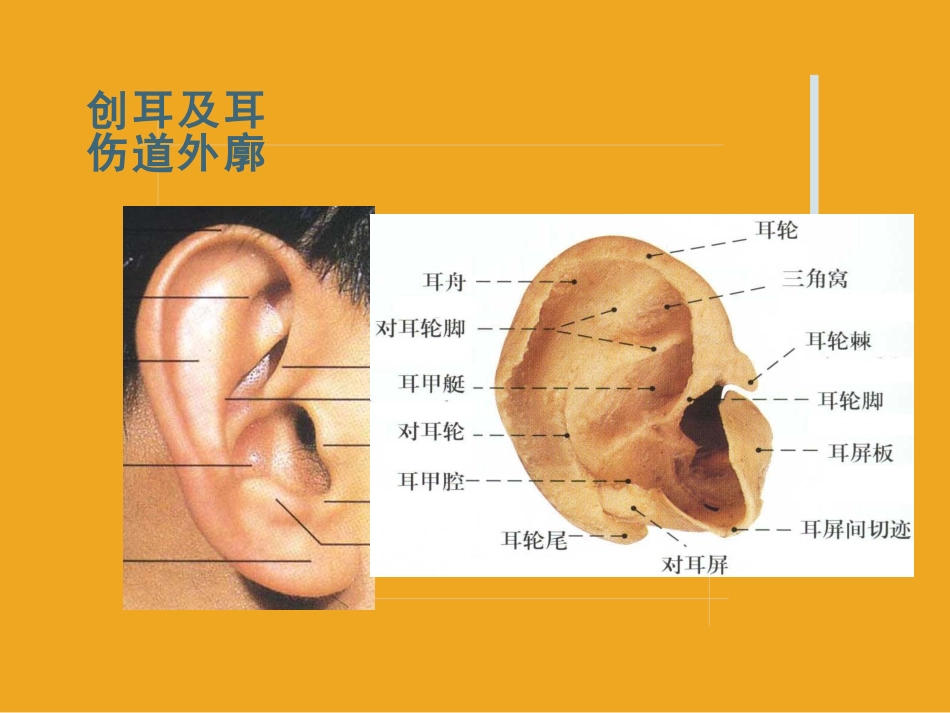 耳鼻喉头颈外科课件耳创伤_第3页