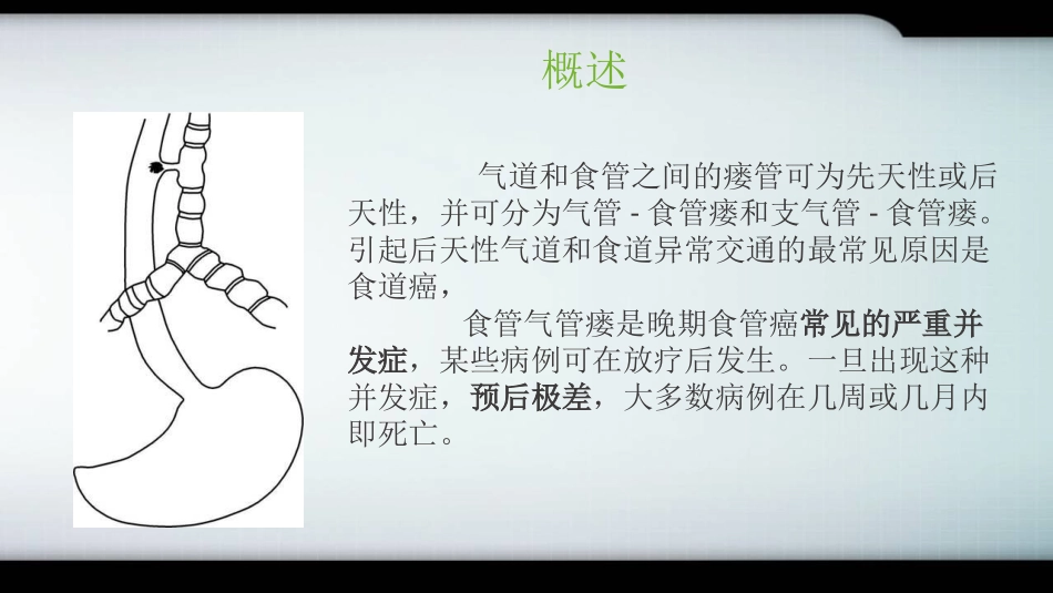 放疗后气管食管瘘的治疗_第2页