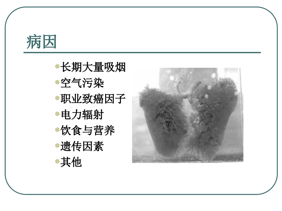 肺癌病理分型_第3页