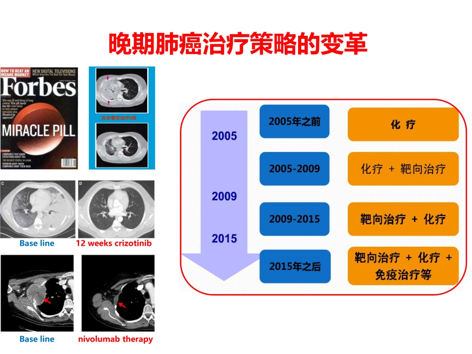 肺癌寡转移治疗进展_第2页