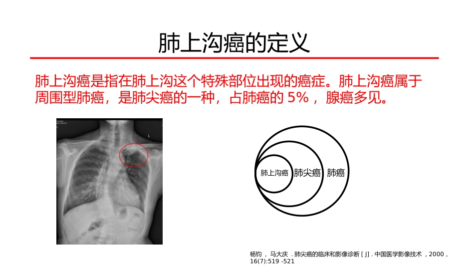 肺上沟癌的鉴别诊疗_第3页