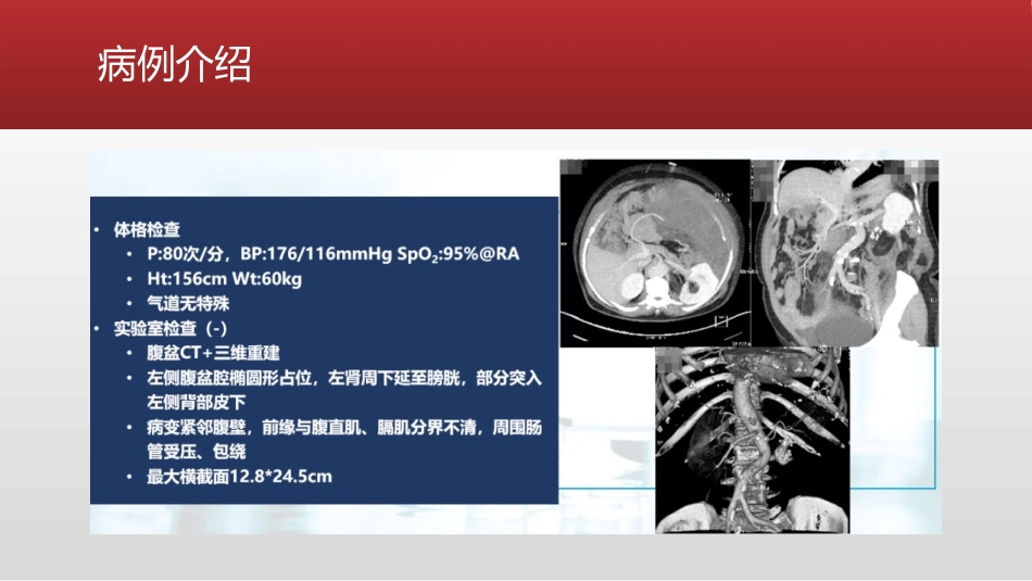 腹膜后巨大肿物切除术的麻醉管理_第3页