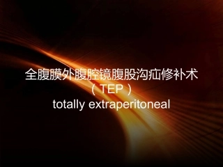 腹腔镜腹股沟疝