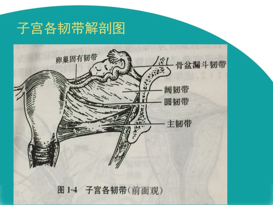 腹腔镜下全子宫切除术讲解_第3页